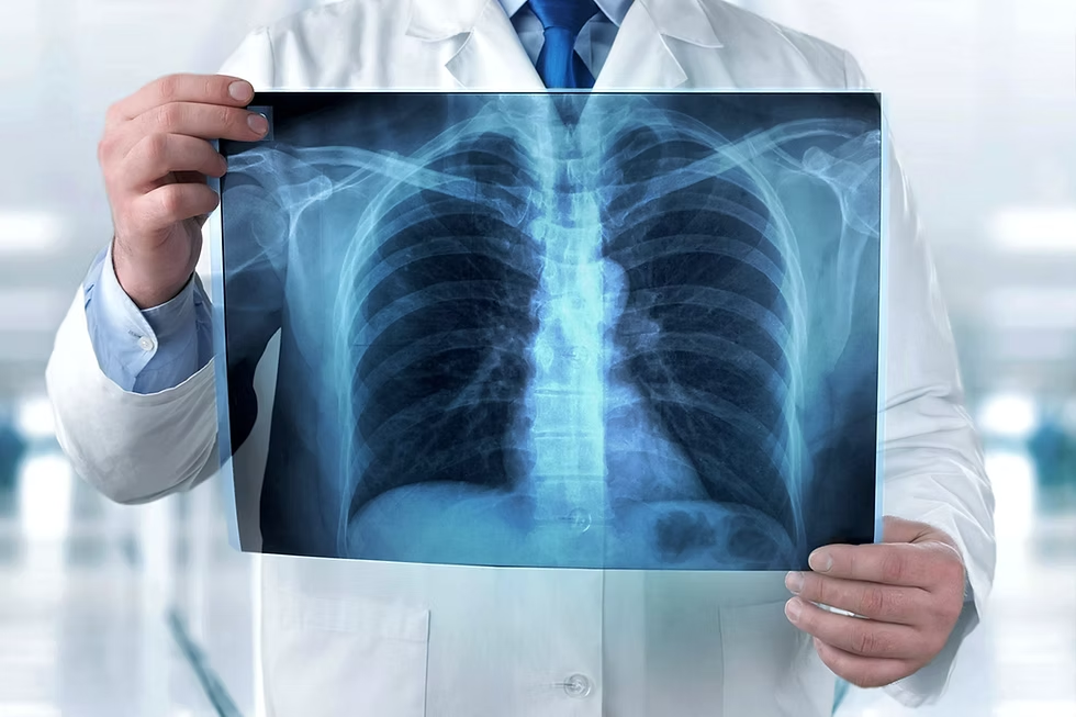 Grand Launch Advanced CT Scan