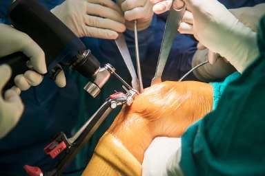 KNEE REPLACEMENT 2